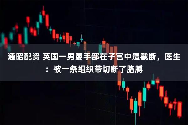 通昭配资 英国一男婴手部在子宫中遭截断，医生：被一条组织带切断了胳膊